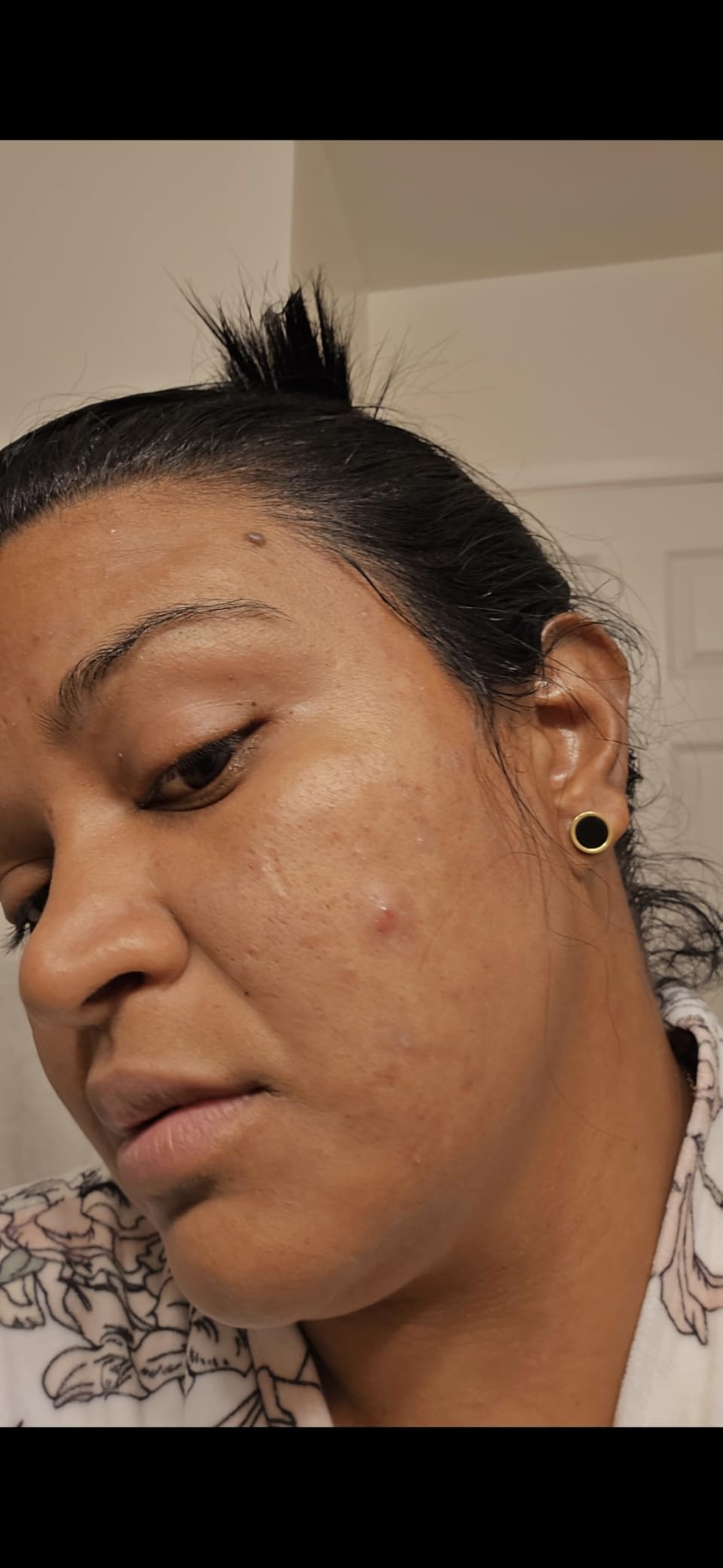 La Roche-Posay Glycolic Acid Dark Spot Serum with Vitamin B5, 1oz | Tranexamic acid and kojic acid skin tone corrector that helps reduce discoloration, brighten skin, and even skin tone. customer photo 2