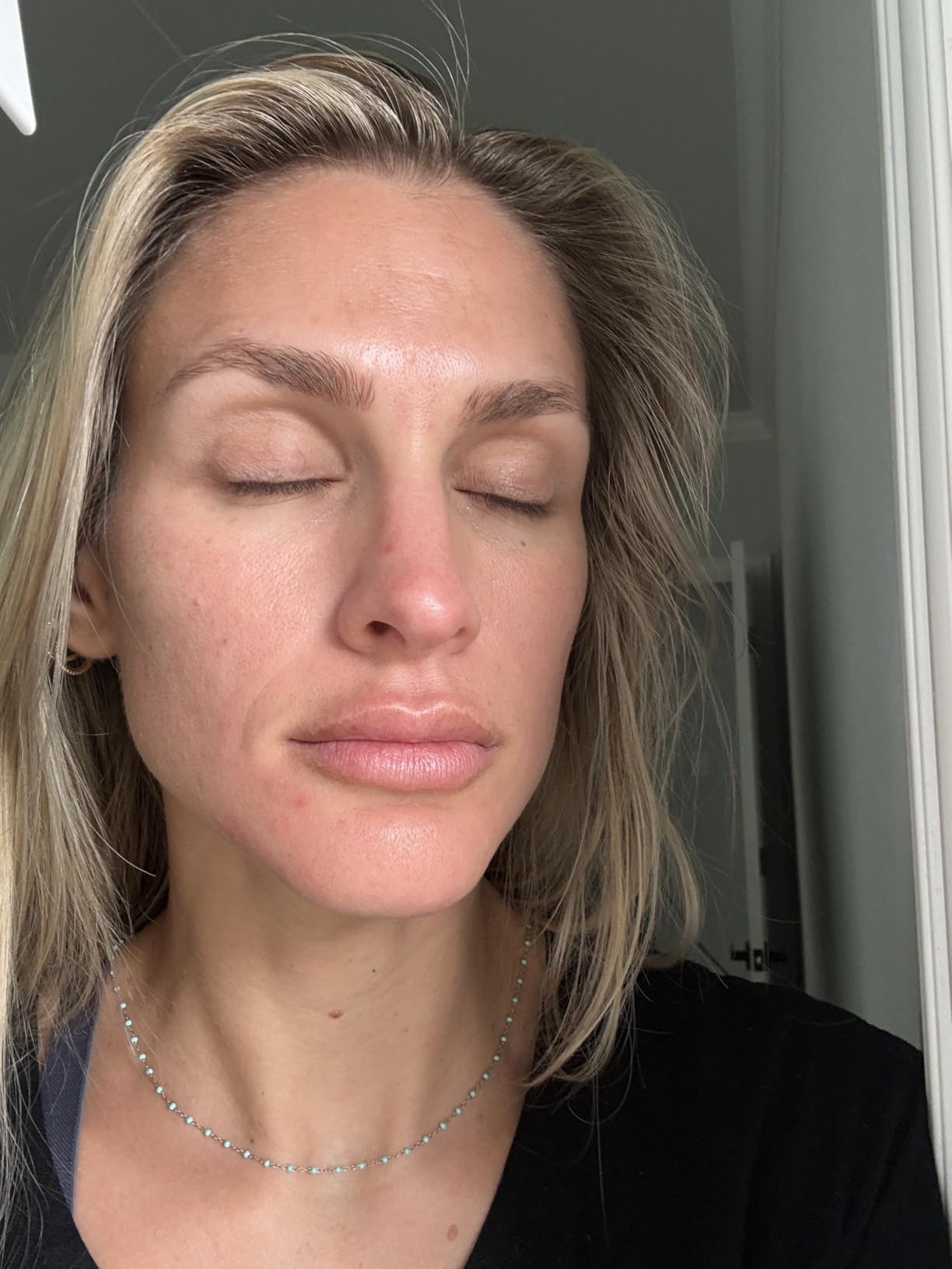 Paula's Choice SKIN PERFECTING 2% BHA Liquid Exfoliant | Gentle Salicylic Acid Facial Exfoliator for Blackheads, Enlarged Pores, Wrinkles & Fine Lines customer photo 1
