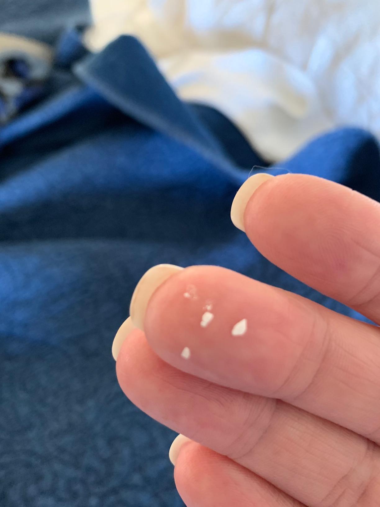 SkinMedica TNS Ceramide Treatment Facial Cream - Hydrating Facial Moisturizer with Peptides & Ceramide Technology to Help Restore Skin's Moisture Balance & Barrier (2 Oz) customer photo 1