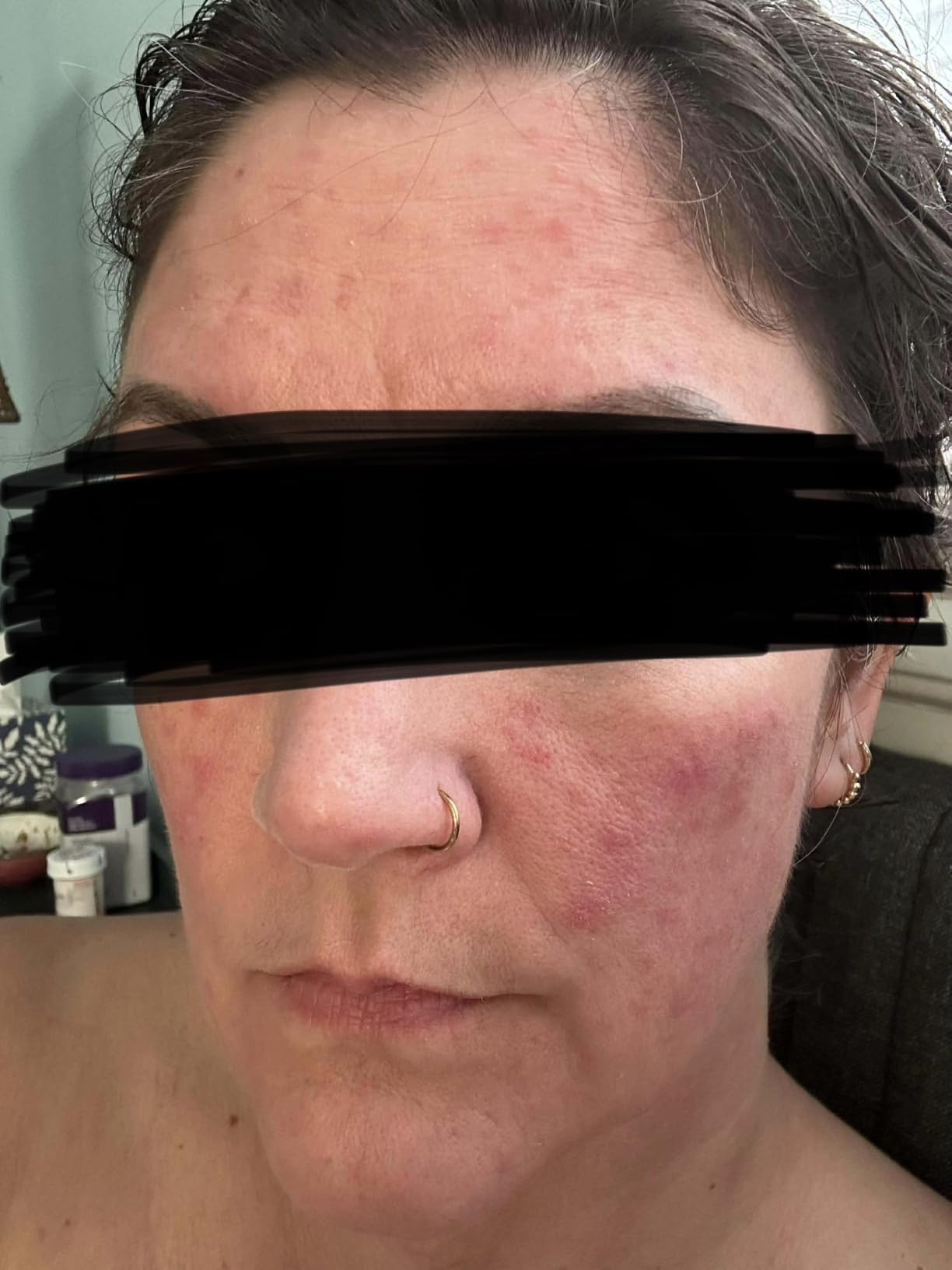 Paula's Choice BOOST 10% Azelaic Acid Booster Cream Gel, 1 Fl Oz | Oil-Free Serum Fades Discoloration & Post-Blemish Marks with Licorice Extract & Salicylic Acid, Fragrance-Free customer photo 2