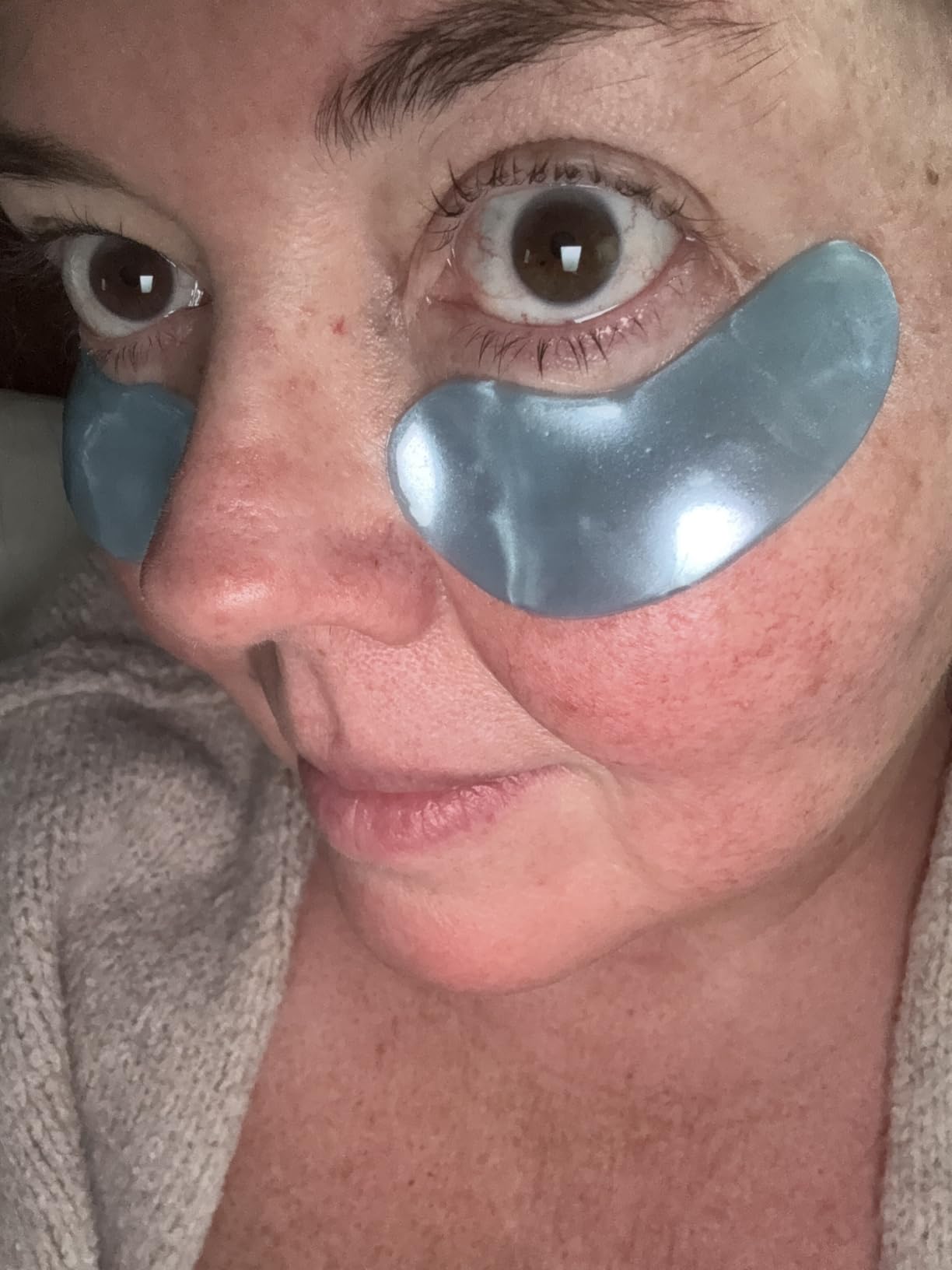 grace & stella Award Winning Under Eye Mask - Birthday Gifts for Women - Gel Eye Patches for Dark Circles, Puffy Eyes, Undereye Bags - Gifts for Mom - Vegan Self Care (24 Pairs, Gold) customer photo 1