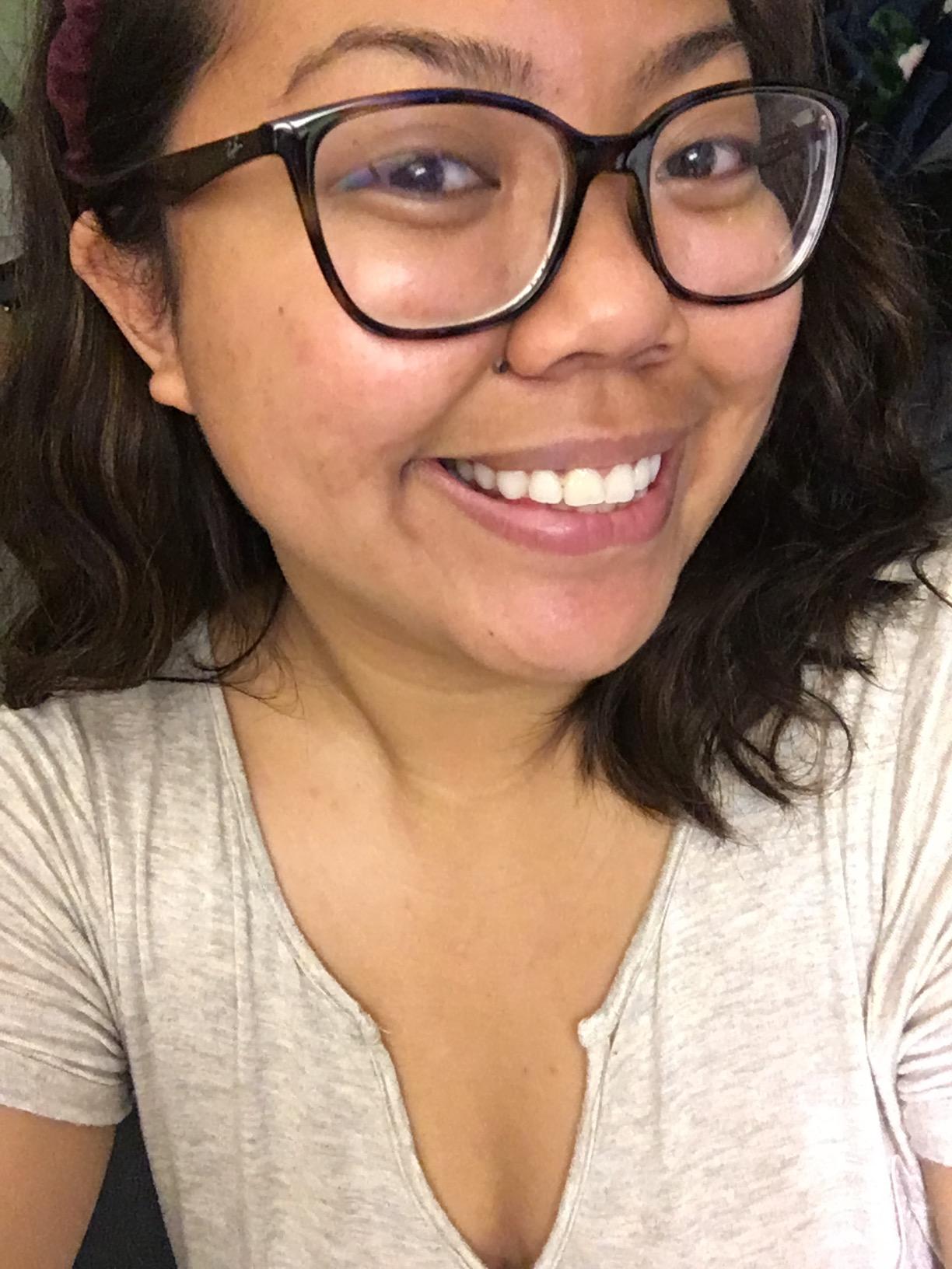 The Ordinary 100% Plant-Derived Squalane, for Skin and Hair, Lightweight Hydration, and Moisture Barrier Support, 1 Fl Oz customer photo 2