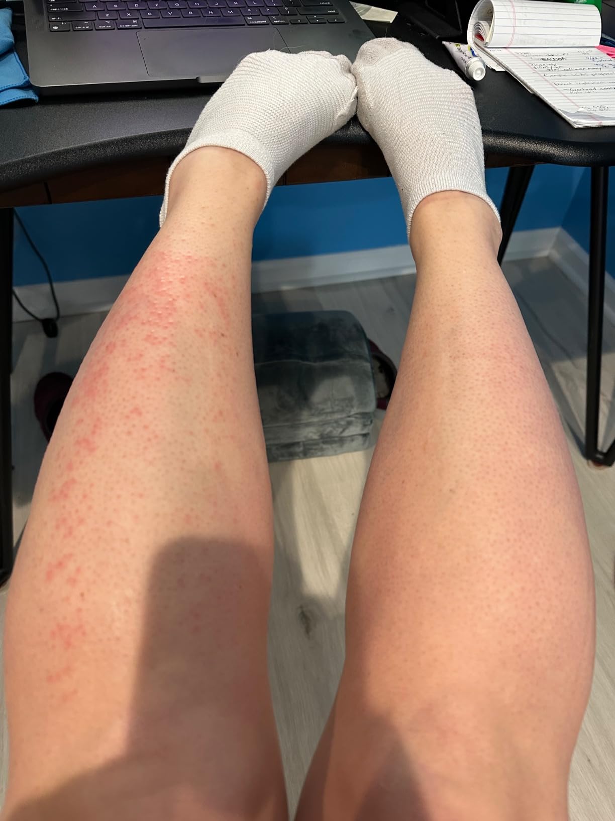 Braun IPL, Silk·Expert Pro 5, IPL Hair Removal for Women and Men, Permanent Laser Hair Reduction At-Home, 2 Heads, Pouch, IPL5137 customer photo 1