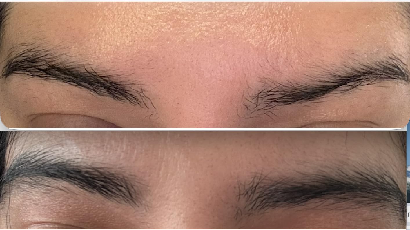 Obagi Nu-Cil Eyebrow Boosting Serum - 6ml customer photo 1