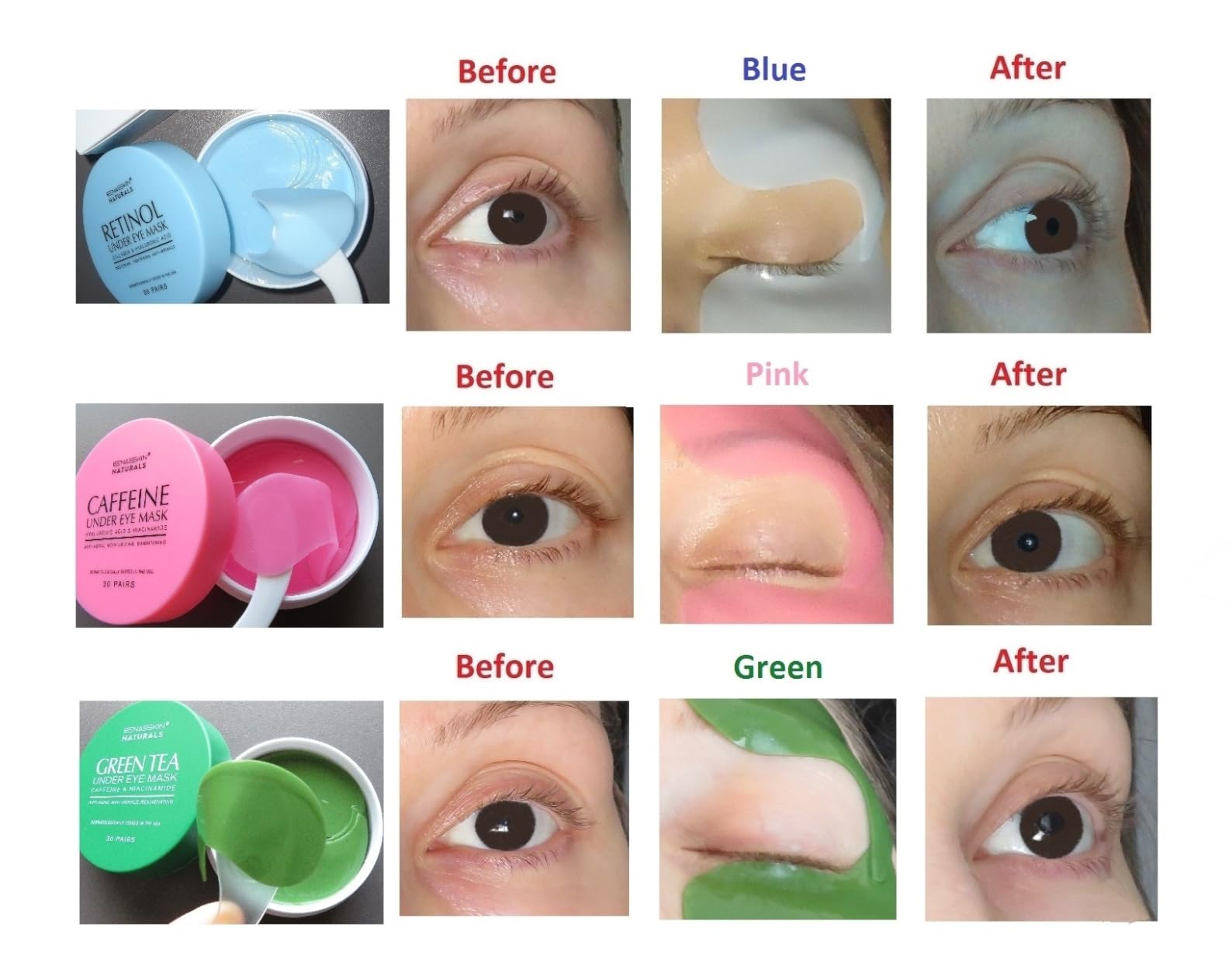 Enaskin Naturals Under Eye Patches for Puffy Eyes & Dark Circles 60 Patches | Each Gel Patch Delivers Retinol and Collagen to Visibly Soften Fine Lines and Wrinkles Around the Delicate Eye Area customer photo 1