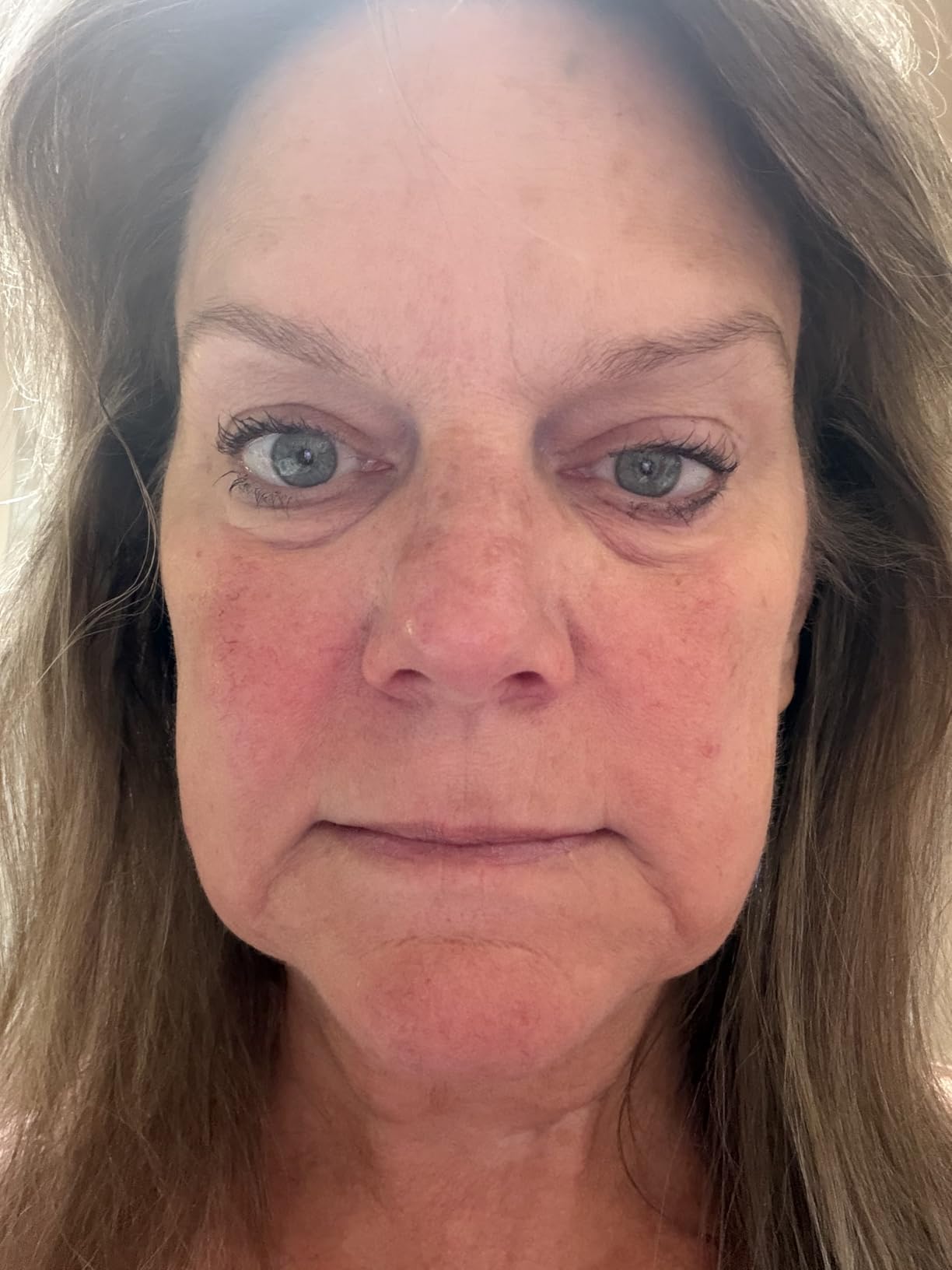 Enaskin Naturals Under Eye Patches for Puffy Eyes & Dark Circles 60 Patches | Each Gel Patch Delivers Retinol and Collagen to Visibly Soften Fine Lines and Wrinkles Around the Delicate Eye Area customer photo 2