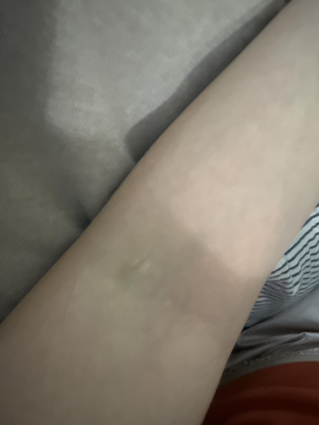 Solawave 4-in-1 Red Light Therapy Wand for Face & Neck (Rose Gold) | FDA-cleared for face wrinkles. Red Light Therapy, Galvanic Current, Warmth & Massage work together for firmer, glowing skin. customer photo 1