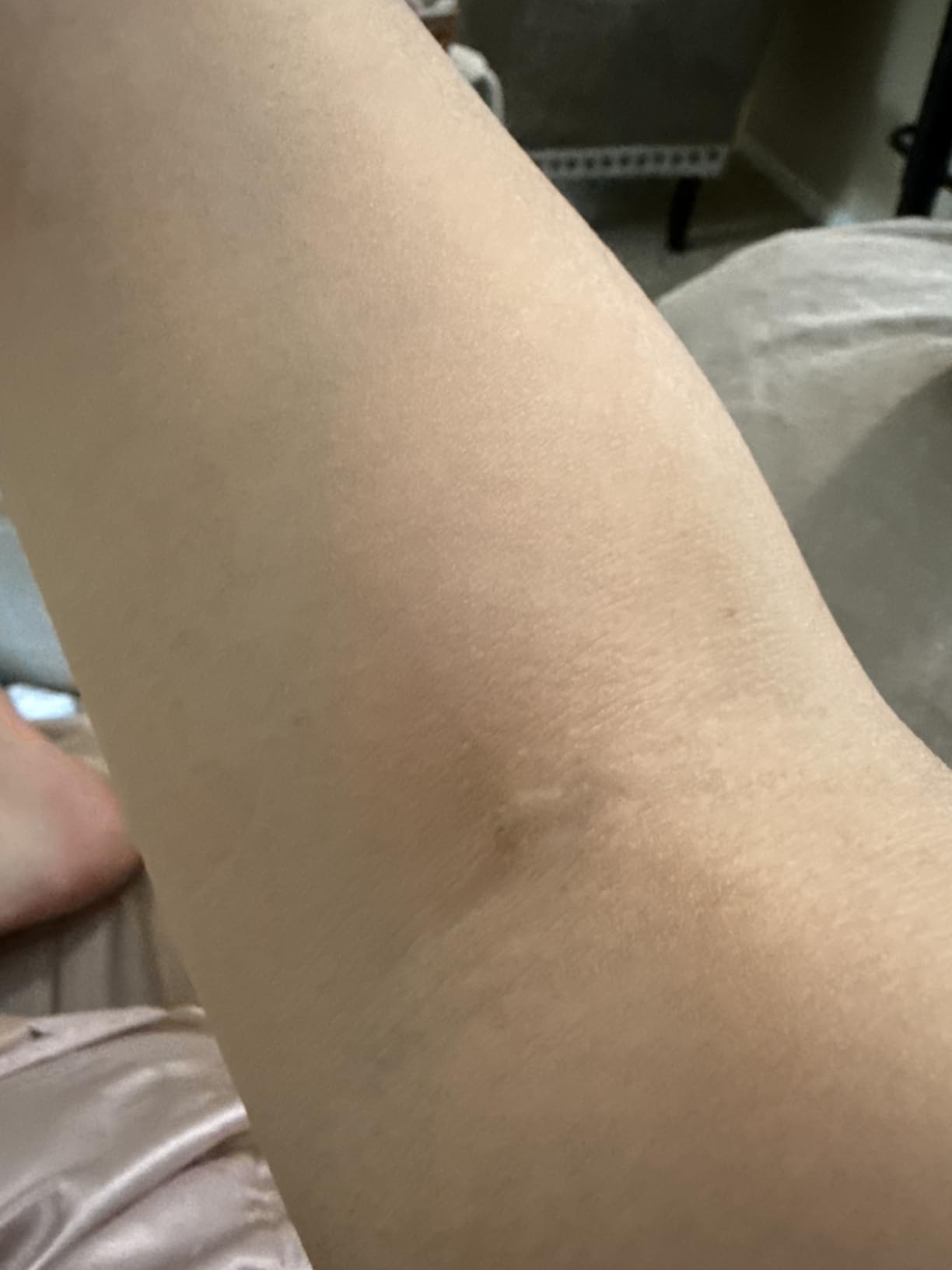 Solawave 4-in-1 Red Light Therapy Wand for Face & Neck (Rose Gold) | FDA-cleared for face wrinkles. Red Light Therapy, Galvanic Current, Warmth & Massage work together for firmer, glowing skin. customer photo 2