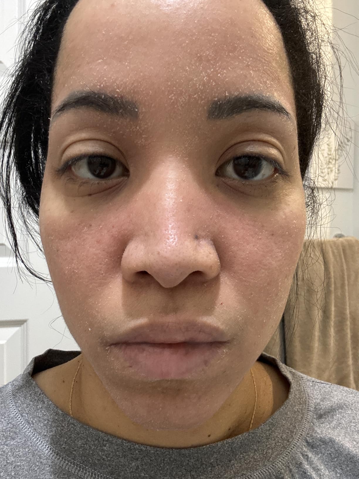 Paula's Choice RESIST Barrier Repair Advanced Face Moisturizer | Face Cream with Ceramides & Peptides for Deep Hydration & Wrinkles, Anti-Aging for All Skin Types, Fragrance-Free customer photo 2