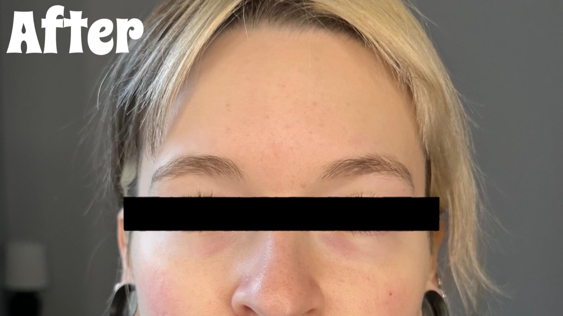 DRMTLGY Brightening Eye Masks 60 Count | Hydrogel Under Eye Patches | Depuffing, Dark circle brightening, Peptides, Caffeine, Hyaluronic acid, Niacinamide customer photo 1