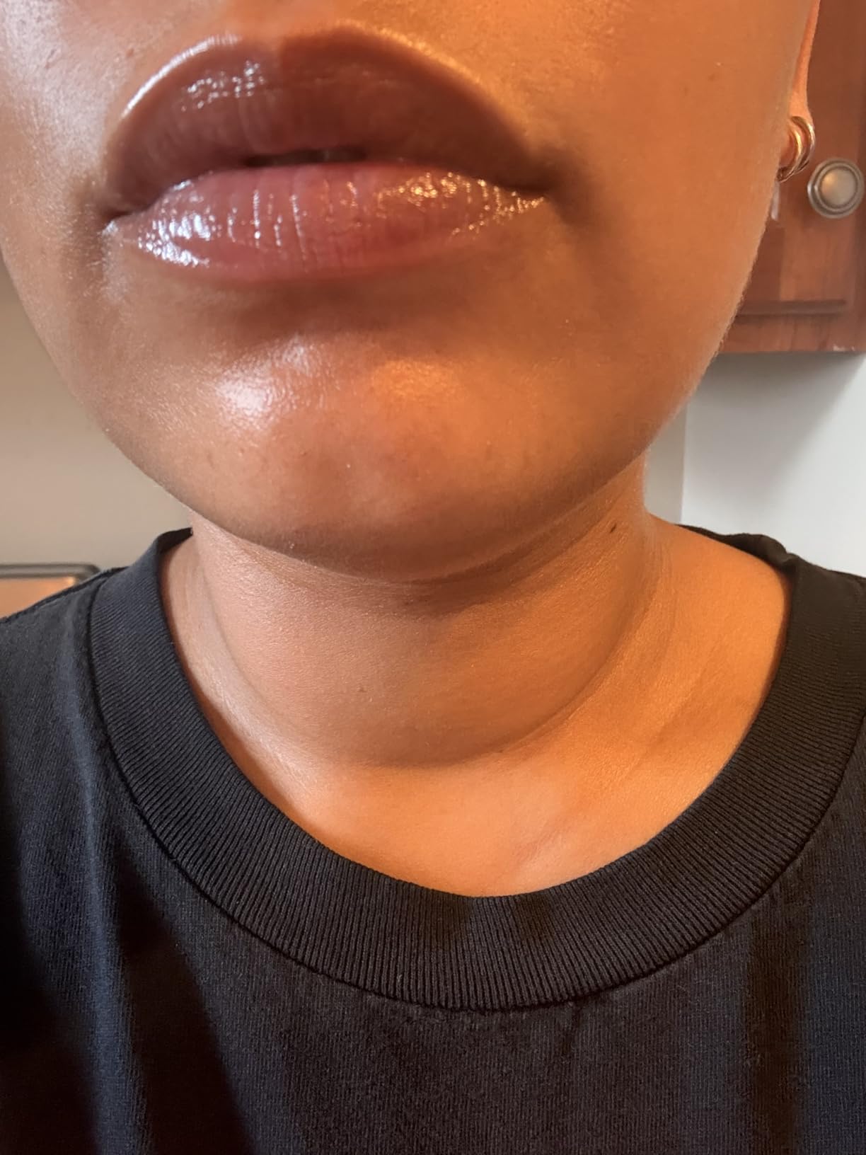 The Lip Balm. Hydrating Hyaluronic Acid Lip Balm. Niacinamide + Shea Butter | For Women & Men. With Ceramides, Non-Comedogenic. Relieves Dry, Chapped Lips. 15ml / 0.5 fl oz. customer photo 1