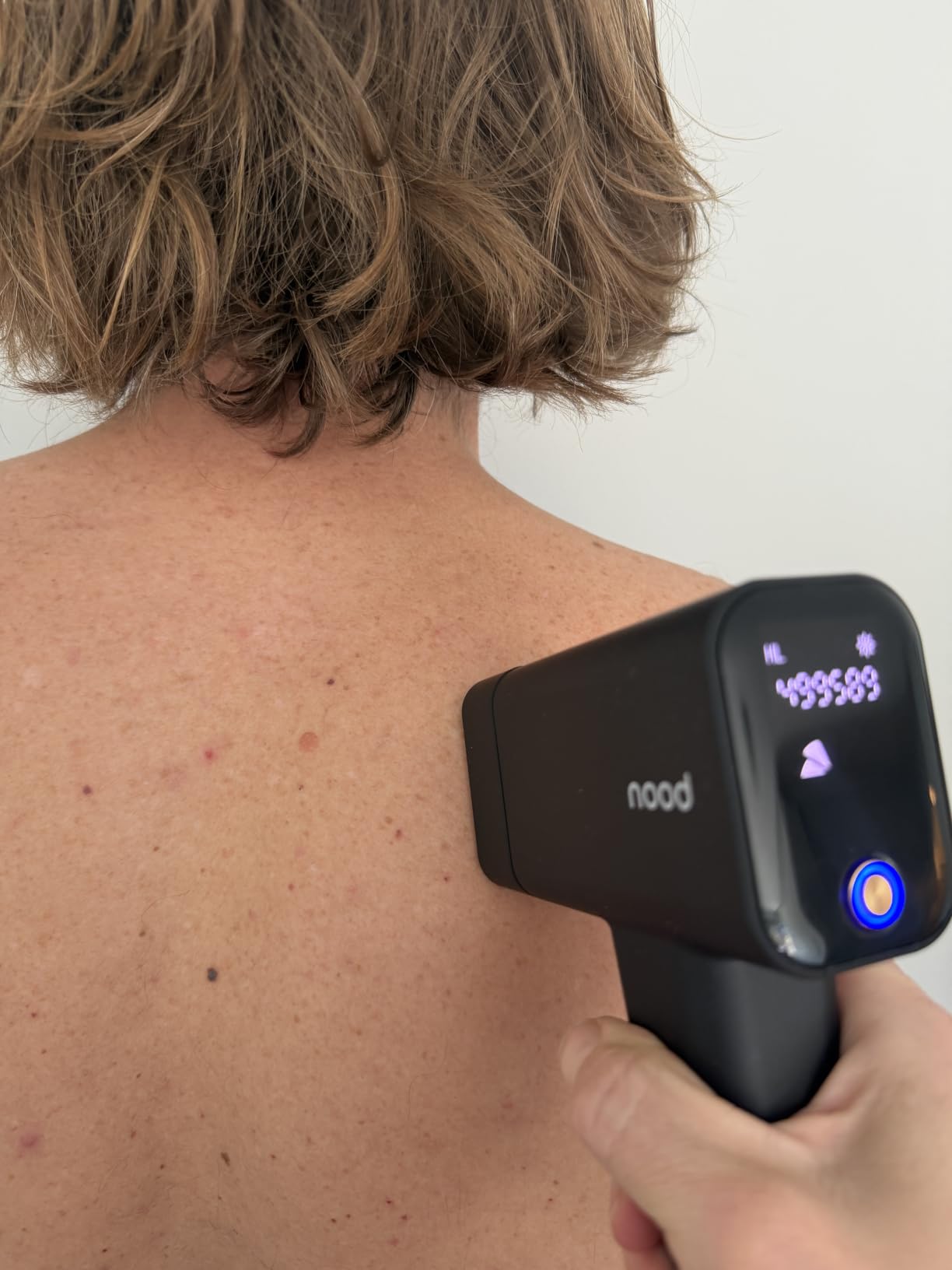 Nood Flasher Pro | IPL Laser Hair Removal Device, Forbes Best Product 2026 | Clinical-Grade Permanent Results At Home, CryoSoothe Tech with 5 Power Settings, Pain-Free 10 Min Sessions, Works Everywhere customer photo 1