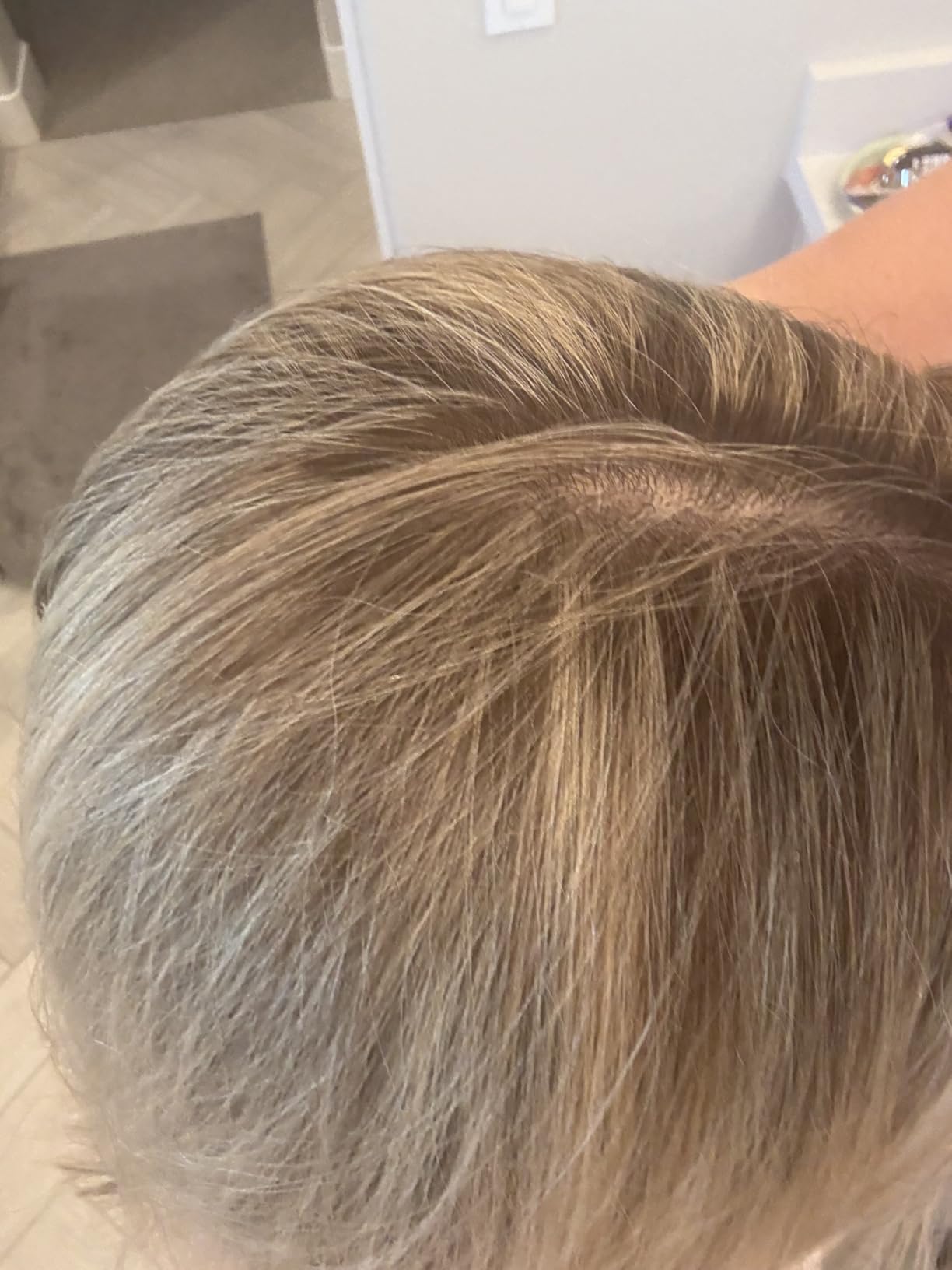 K18 AirWash Dry Shampoo, Non-Aerosol, Balances Scalp & Controls Excess Oil Production customer photo 1