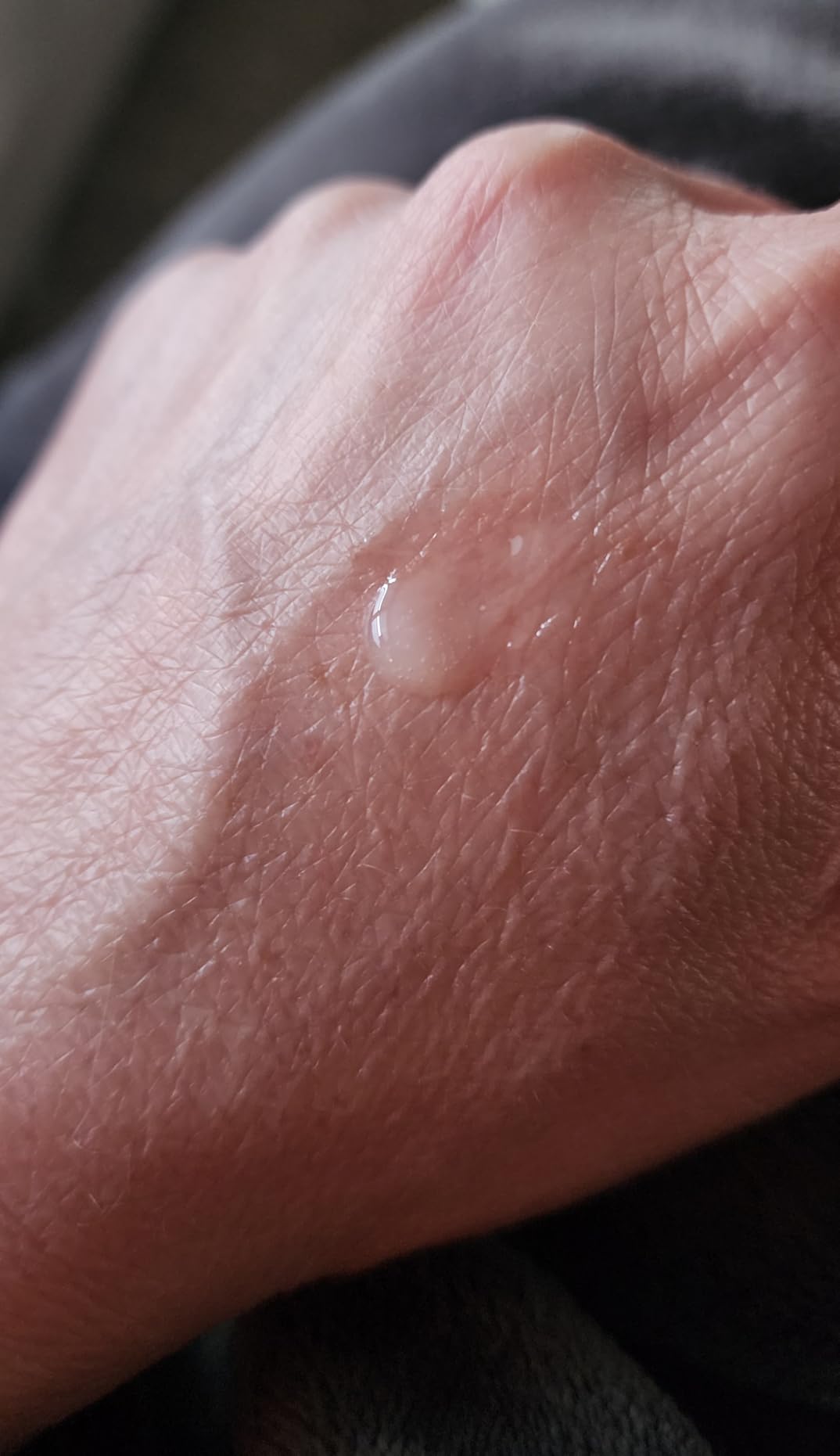 HARUHARU Rose PDRN Peptide Glowy Balm, 0.33 fl.oz, Glossy Clear, Vegan | Long Lasting Hydration for Dry Cracked Lips, Dewy Lips, No Waxy Finish, Silicon Free, Micro Plastic Free, Korean Skin care customer photo 1
