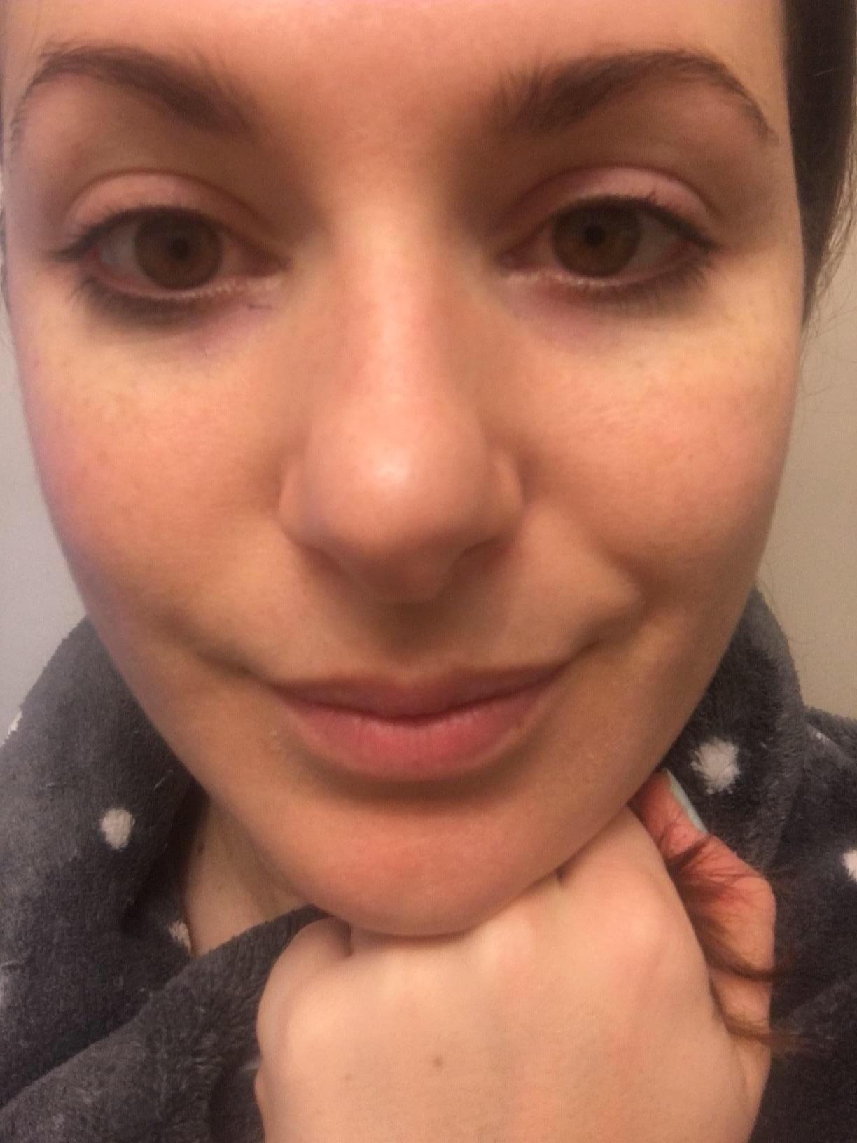 MIZON Snail Repair Intensive Ampoule, Korean Snail Serum 1.01 fl oz | Hyaluronic Acid, Peptides, Vitamin E, Hydrating, Elasticity & Glass Skin Look customer photo 2