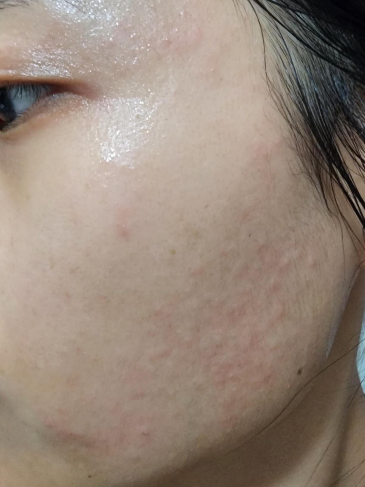 COSRX Niacinamide 2% + BHA 4% Blackhead Exfoliant Korean Toner, 3.38fl.oz | Pore Minimizer for Enlarged Pores, Sebum Control, Smooth Texture Care, for All Skin Types, K-Beauty Essential customer photo 2