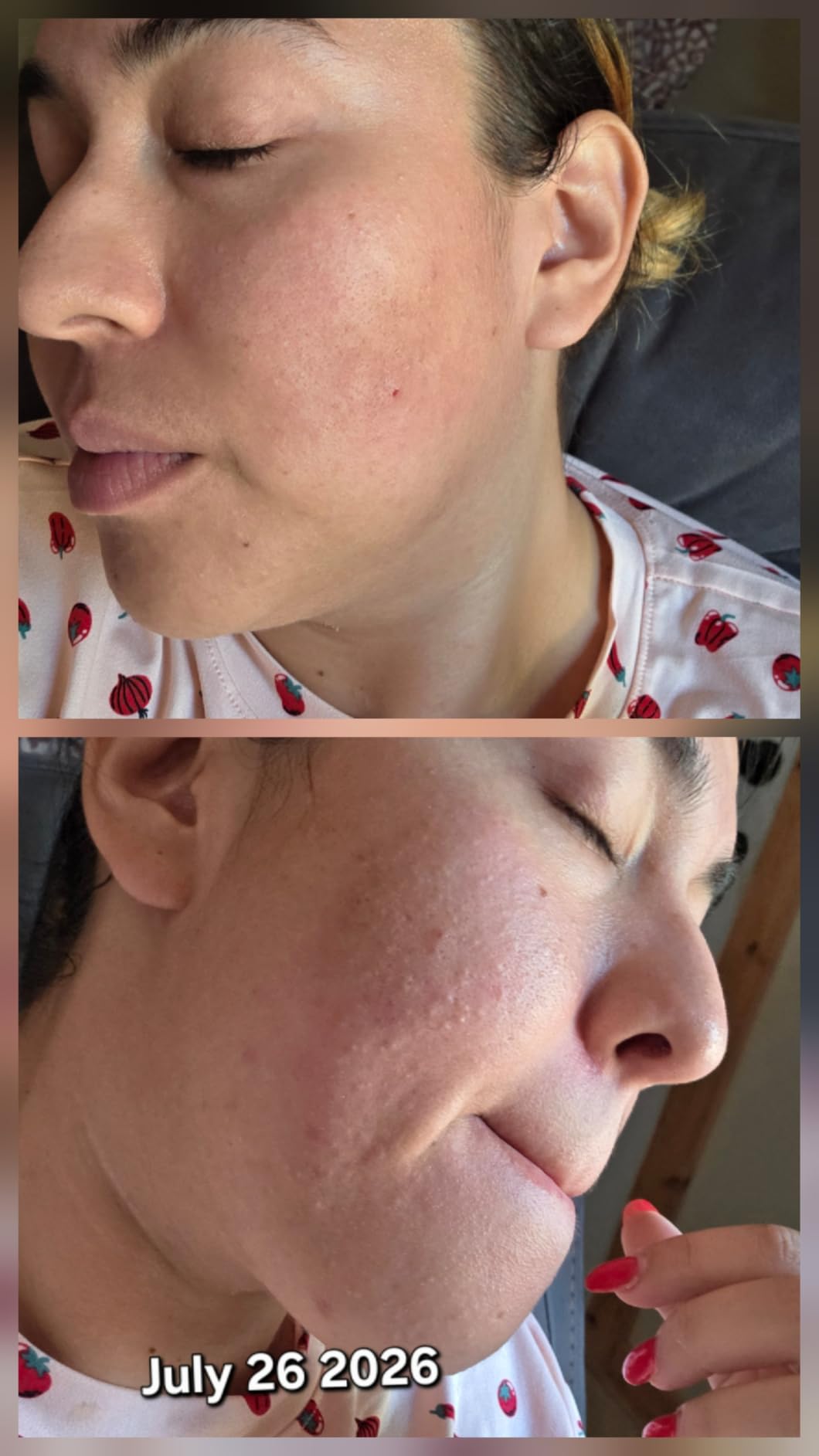 Paula's Choice SKIN PERFECTING 2% BHA Liquid Exfoliant | Gentle Salicylic Acid Facial Exfoliator for Blackheads, Enlarged Pores, Wrinkles & Fine Lines customer photo 1