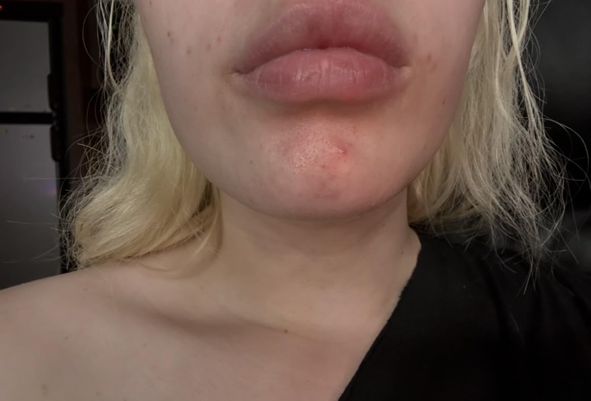 Paula's Choice SKIN PERFECTING 2% BHA Liquid Exfoliant | Gentle Salicylic Acid Facial Exfoliator for Blackheads, Enlarged Pores, Wrinkles & Fine Lines customer photo 2